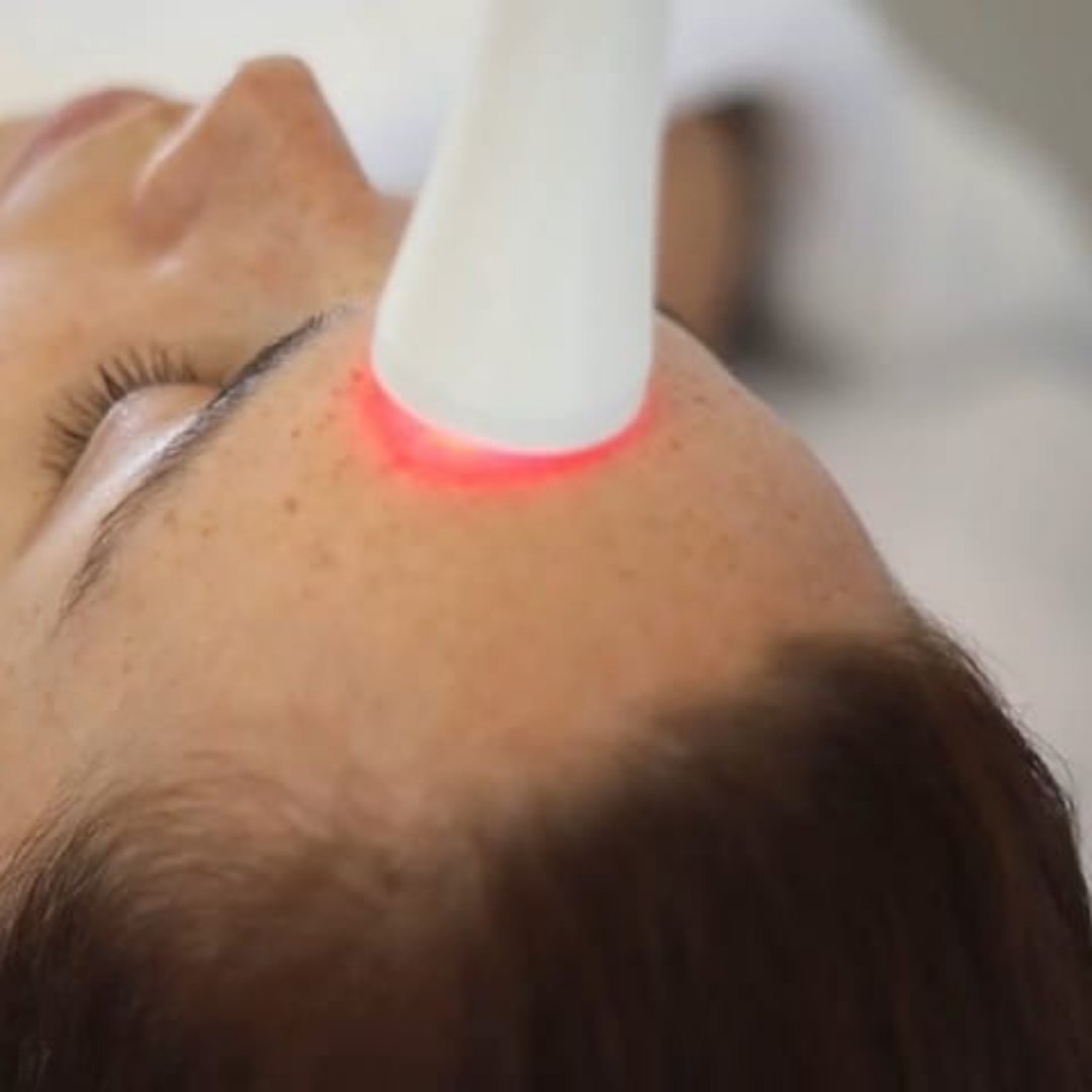 Manipolo MESOLUX a contatto con la fronte di una cliente durante il trattamento, con luce rossa